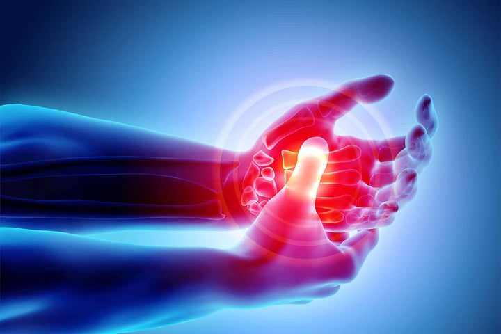 Prevent Arthritis