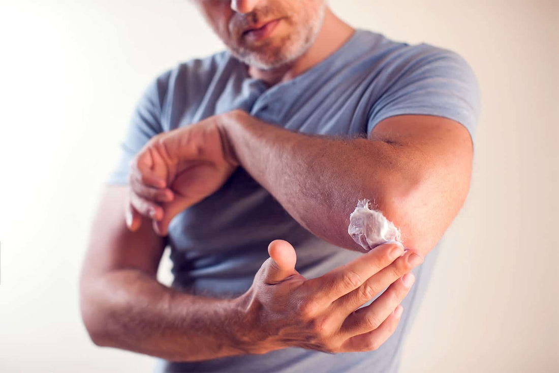 Topical Pain Relief
