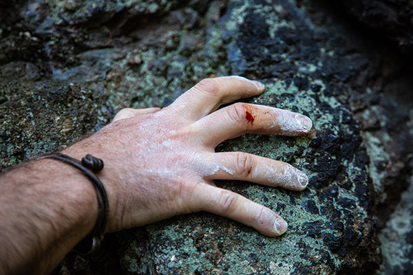 CBD Can Aid Climbers in Overcoming Finger Injuries